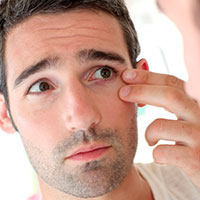 Blépharoplastie inférieure, chirurgie esthétique pour hommes, Toulouse